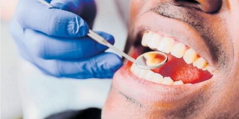 man getting his teeth checked at dentist 