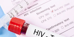 A HIV specimen