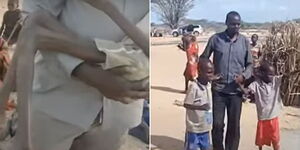 Collage photos of the two children from Turkana County who were malnourished.