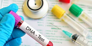 File photo of samples collected for DNA test