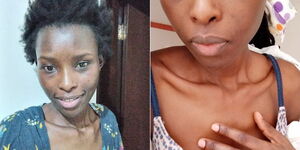 An emaciated Diana Chepkemoi, a Kenyan student seeking to come back to Kenya from Saudi Arabia. 