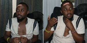 Umoja One MCA Mark Mugambi recounting how he was beaten up on Thursday, January 26, 2023.