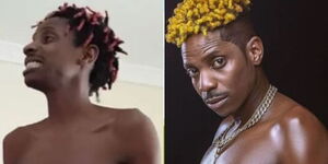 A before and after photo of comedian Eric Omondi