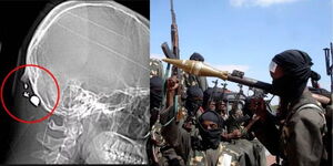 al-Shabaab bullet