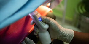 Cervical cancer treatment