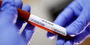 A medical personnel holding a Covid-19 virus test kit.