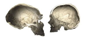 DNA skull