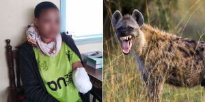 Hyena Attack Victim