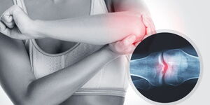 A photo of an injured elbow.