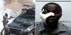 A photo collage of a police officer captured lobbying tear gas into a car ferrying journalists (left) and NTV Cameraman Erick Isinta after receiving treatment on March 30, 2023. 