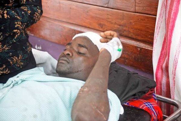 Mr Andrew Murithi, one of the victims of attacks, recovers at Coast General Hospital on November 24, 2019 