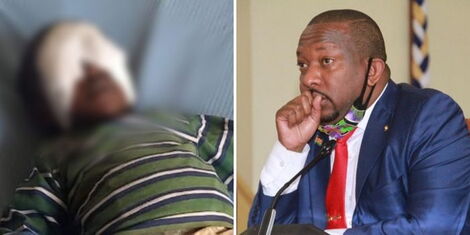 A collage of baby Sagini at the hospital (left) and former Nairobi Governor Mike Sonko (right).