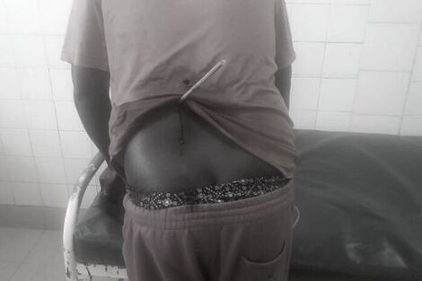 https://www.kenyans.co.ke/files/styles/article_inner_mobile/public/images/media/A%20man%20injured%20from%20the%20skirmishes%20in%20Narok%20on%20Monday%2C%20May%2025%2C%202020..jpg?itok=Px2y78TX https://www.kenyans.co.ke/files/styles/article_inner_mobile/public/images/media/A%20man%20injured%20from%20the%20skirmishes%20in%20Narok%20on%20Monday%2C%20May%2025%2C%202020..jpg?itok=Px2y78TX