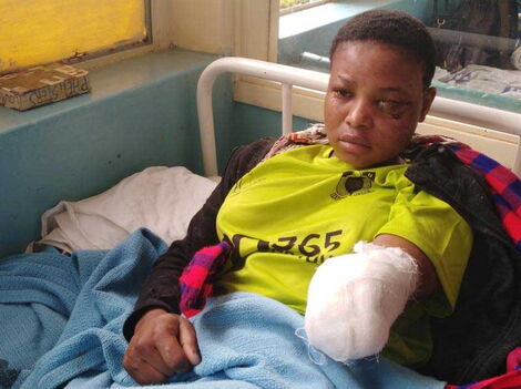 An Image of Irene Mbithe Nursing Injuries in Hospital After the Hyena Attack in 2018.