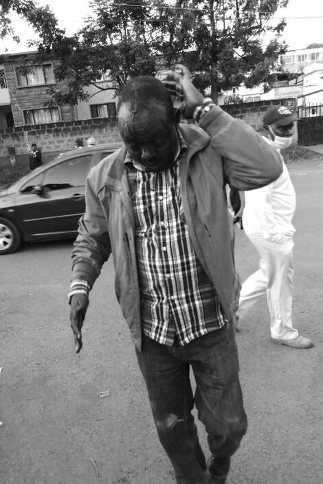 A man identified as Mr. Micah was attacked by goons who have taken over the disputed property in Parklands, Nairobi. [Samson Wire, Standard]