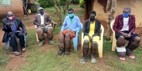 A family suffering from Elephantiasis